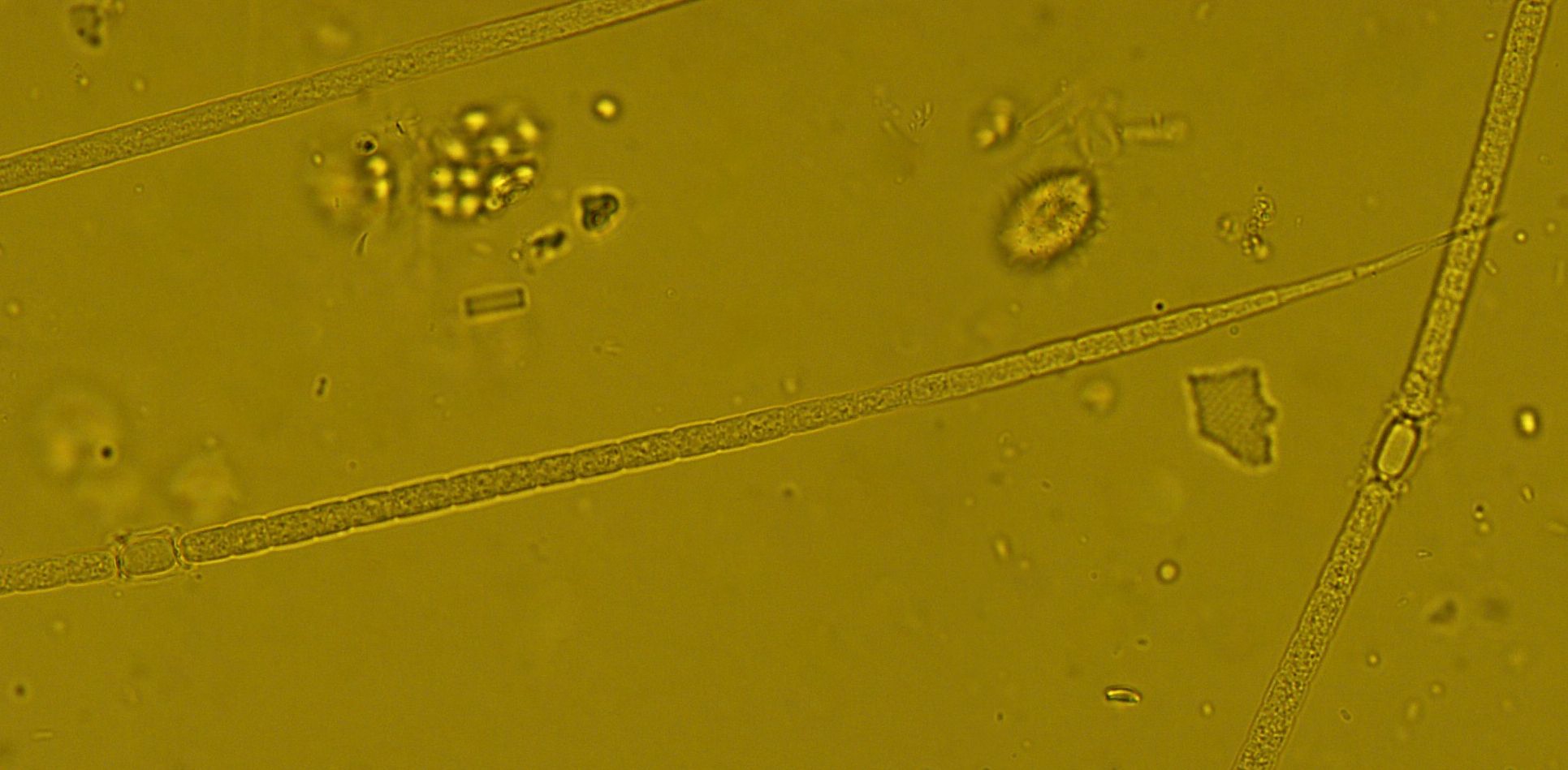 Dictyocha speculum