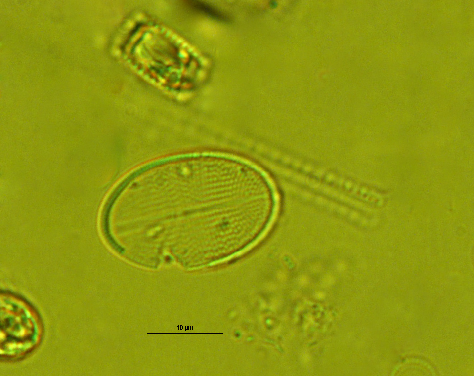Dictyocha speculum