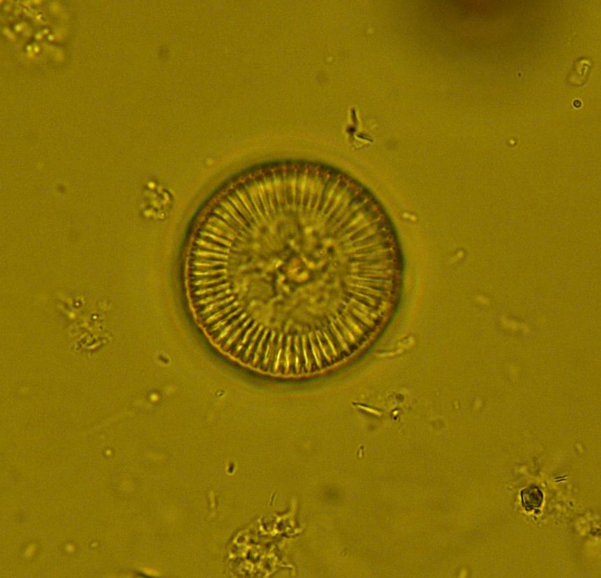 Dictyocha speculum