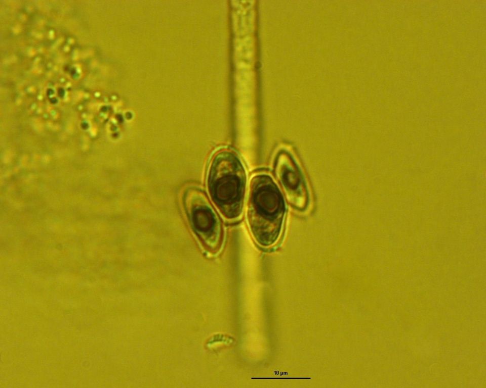 Dictyocha speculum
