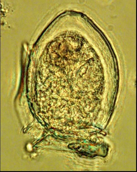 Dictyocha speculum