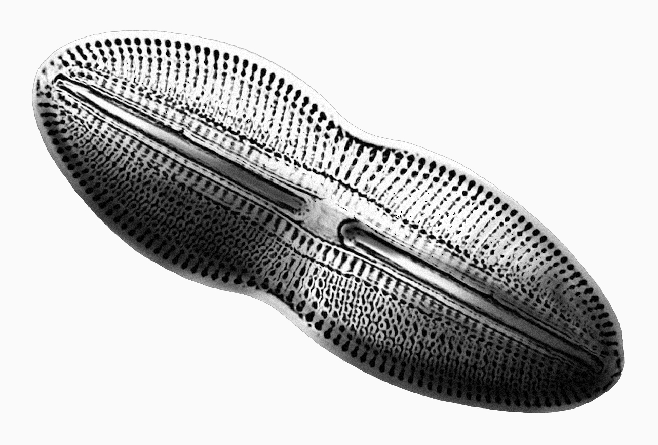 Dictyocha speculum