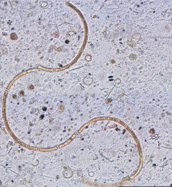 Dictyocha speculum