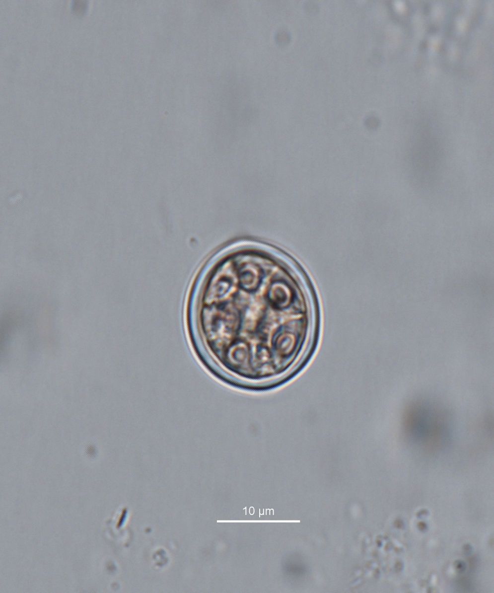 Dictyocha speculum