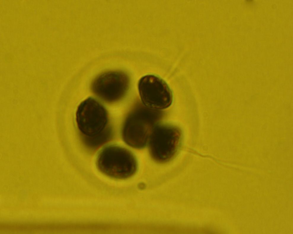Dictyocha speculum