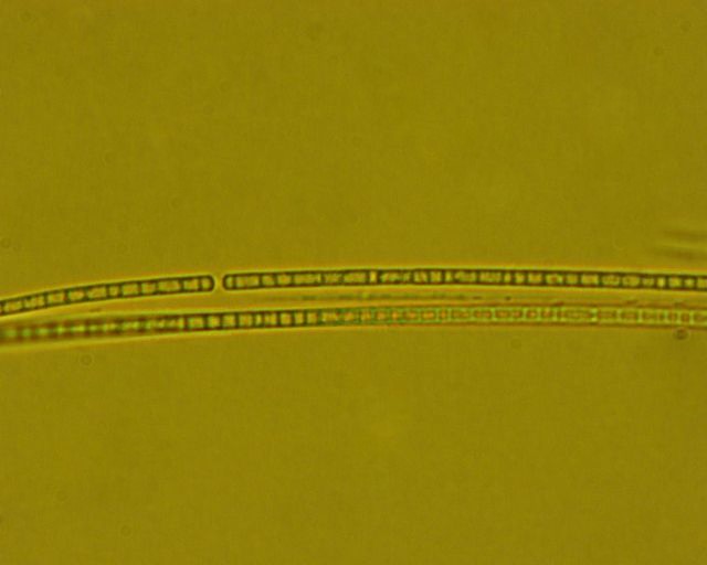 Dictyocha speculum
