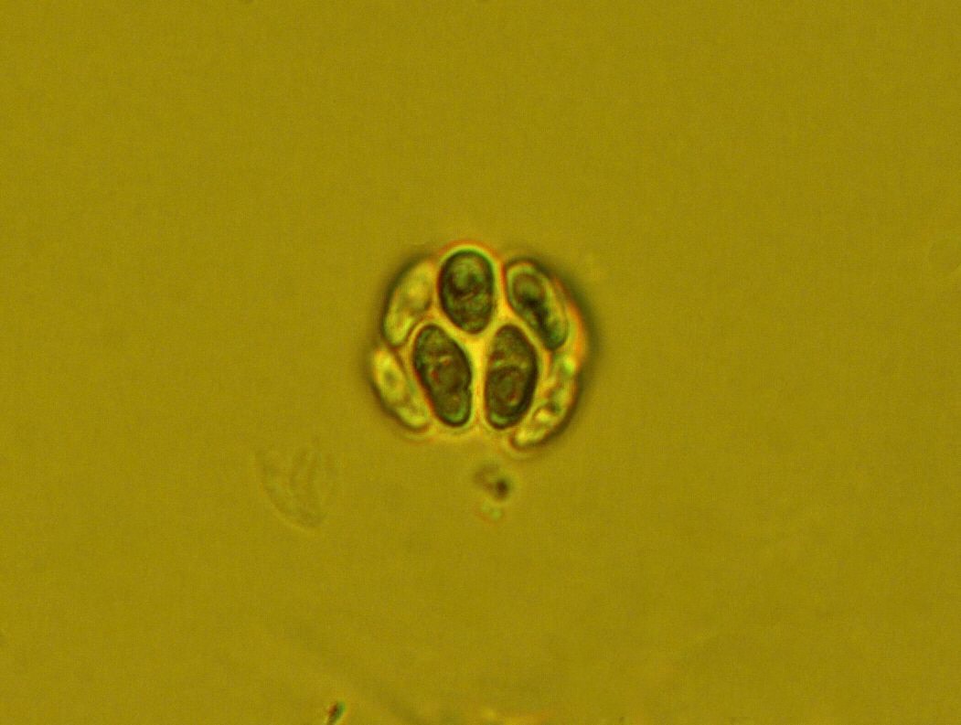 Dictyocha speculum