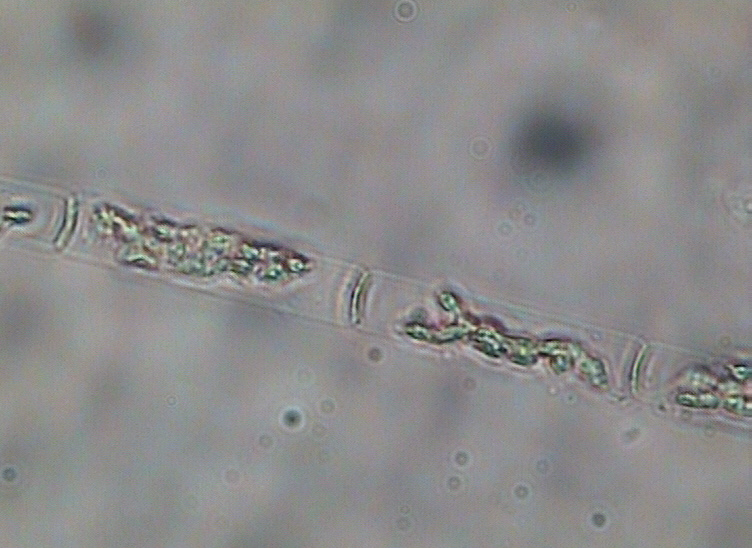 Dictyocha speculum